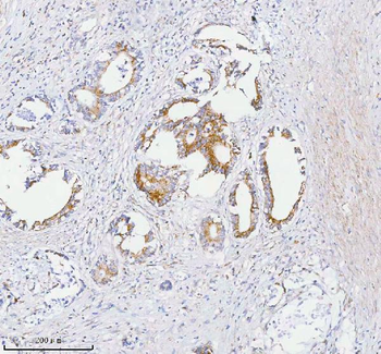 SASS6 Rabbit Polyclonal Antibody