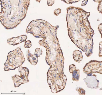 SAMD9L Rabbit Polyclonal Antibody