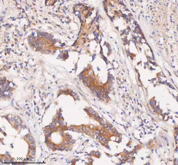 SAMD9L Rabbit Polyclonal Antibody