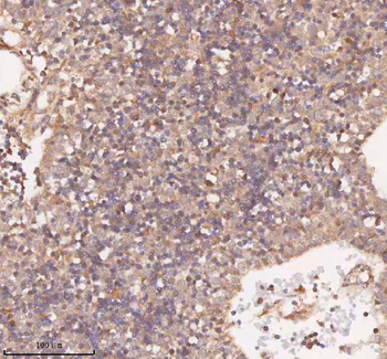 SAMD9L Rabbit Polyclonal Antibody