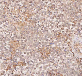 SAMD9L Rabbit Polyclonal Antibody