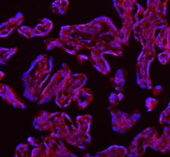 SAMD9L Rabbit Polyclonal Antibody