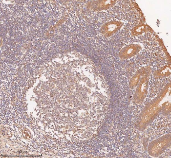 SAMD9L Rabbit Polyclonal Antibody