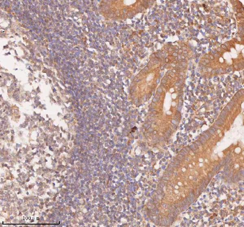 SAMD9L Rabbit Polyclonal Antibody