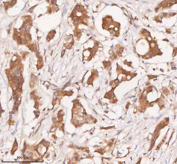 SAMD9L Rabbit Polyclonal Antibody