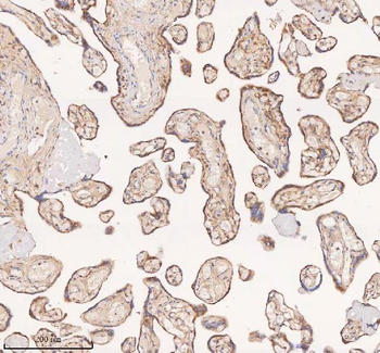 SAMD9L Rabbit Polyclonal Antibody