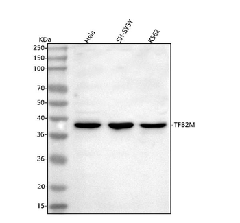 TFB2M Rabbit Polyclonal Antibody