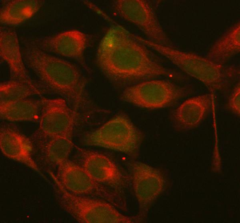 AXIN1 Rabbit Polyclonal Antibody
