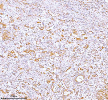 Stanniocalcin 2/STC2 Rabbit Polyclonal Antibody