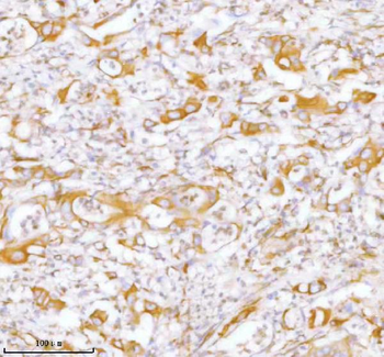 Stanniocalcin 2/STC2 Rabbit Polyclonal Antibody
