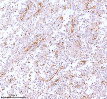 Stanniocalcin 2/STC2 Rabbit Polyclonal Antibody