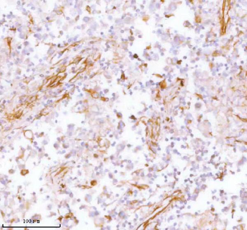 Stanniocalcin 2/STC2 Rabbit Polyclonal Antibody