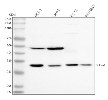 Stanniocalcin 2/STC2 Rabbit Polyclonal Antibody
