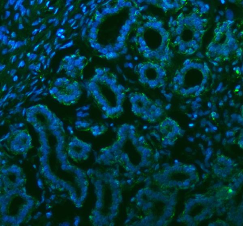 Stanniocalcin 2/STC2 Rabbit Polyclonal Antibody