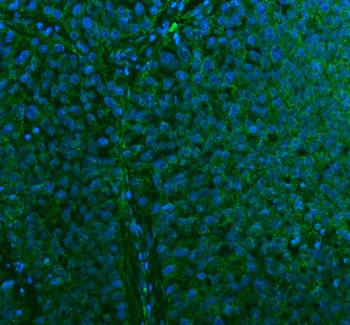 Stanniocalcin 2/STC2 Rabbit Polyclonal Antibody