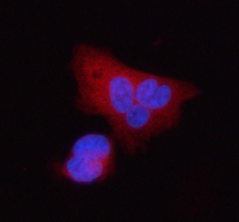 Stanniocalcin 2/STC2 Rabbit Polyclonal Antibody