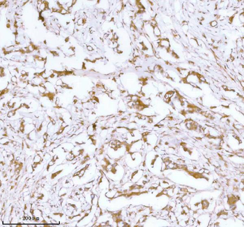 Stanniocalcin 2/STC2 Rabbit Polyclonal Antibody