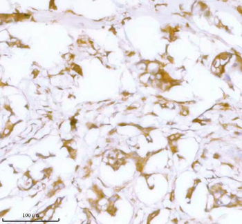 Stanniocalcin 2/STC2 Rabbit Polyclonal Antibody