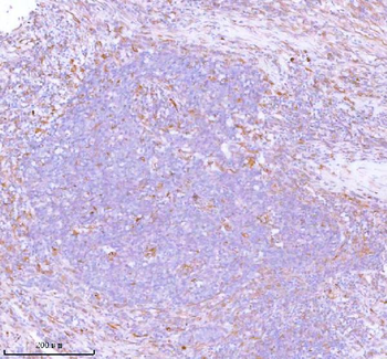 Stanniocalcin 2/STC2 Rabbit Polyclonal Antibody