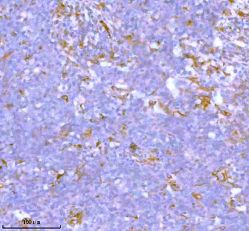 Stanniocalcin 2/STC2 Rabbit Polyclonal Antibody