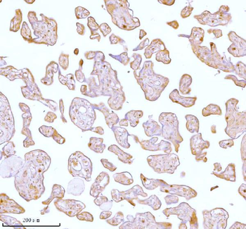 Stanniocalcin 2/STC2 Rabbit Polyclonal Antibody