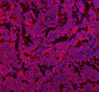 COQ8B Rabbit Polyclonal Antibody