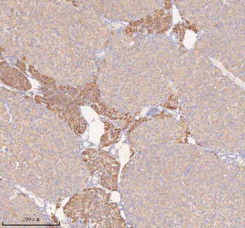 COQ8B Rabbit Polyclonal Antibody