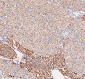 COQ8B Rabbit Polyclonal Antibody