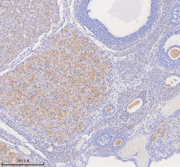 COQ8B Rabbit Polyclonal Antibody