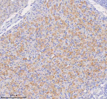 COQ8B Rabbit Polyclonal Antibody