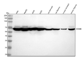 COQ8B Rabbit Polyclonal Antibody
