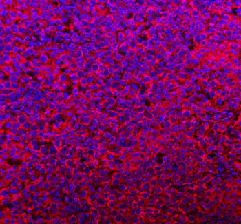 COQ8B Rabbit Polyclonal Antibody
