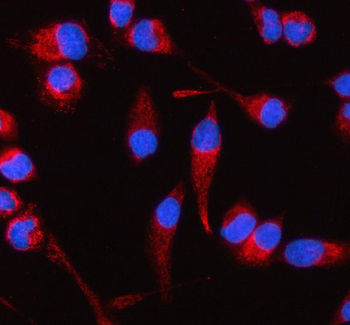 COQ8B Rabbit Polyclonal Antibody