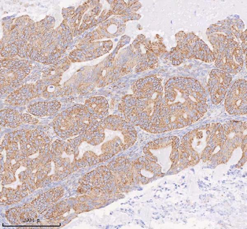 COQ8B Rabbit Polyclonal Antibody