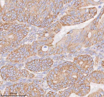 COQ8B Rabbit Polyclonal Antibody