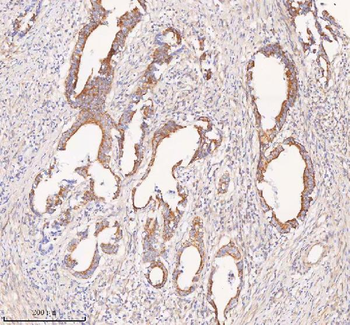 COQ8B Rabbit Polyclonal Antibody
