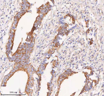 COQ8B Rabbit Polyclonal Antibody