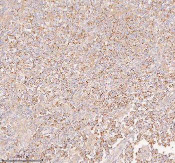 COQ8B Rabbit Polyclonal Antibody