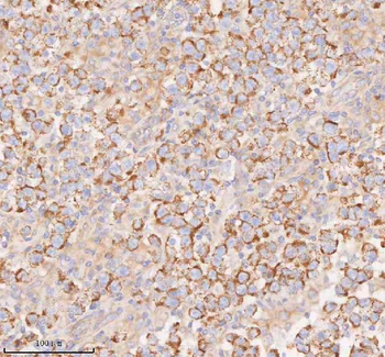 COQ8B Rabbit Polyclonal Antibody