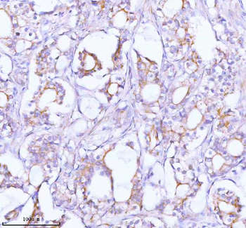 TNIK Rabbit Polyclonal Antibody