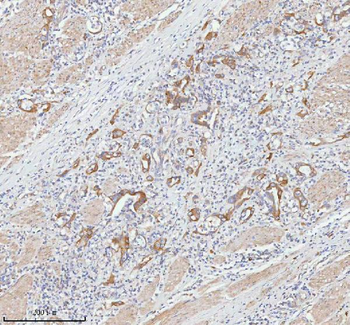 TNIK Rabbit Polyclonal Antibody