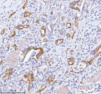 TNIK Rabbit Polyclonal Antibody