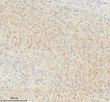 TNIK Rabbit Polyclonal Antibody