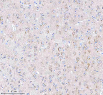 TNIK Rabbit Polyclonal Antibody