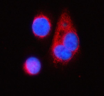 TNIK Rabbit Polyclonal Antibody