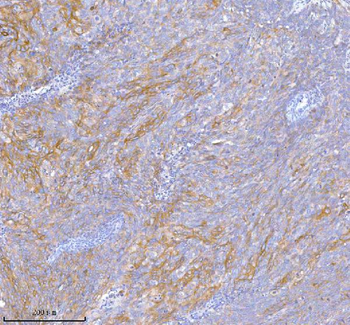 TNIK Rabbit Polyclonal Antibody
