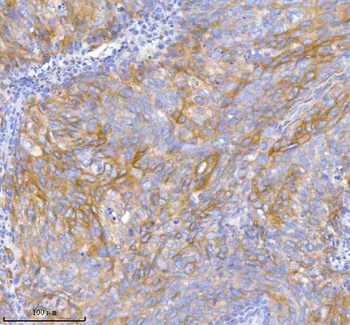TNIK Rabbit Polyclonal Antibody