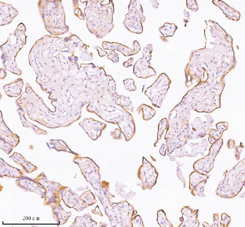 TNIK Rabbit Polyclonal Antibody