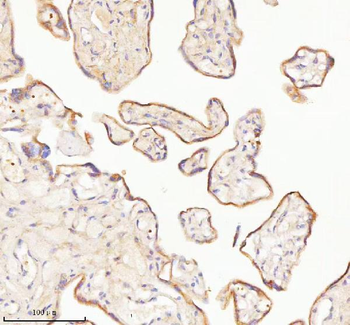 TNIK Rabbit Polyclonal Antibody