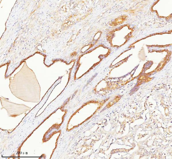 TNIK Rabbit Polyclonal Antibody